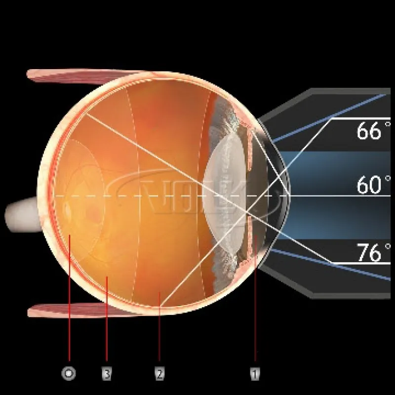 Купити G-3 Gonio-Fundus Україна