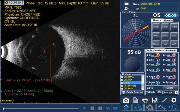 Купити Пристрій ультразвукової діагностики 4Sight Україна